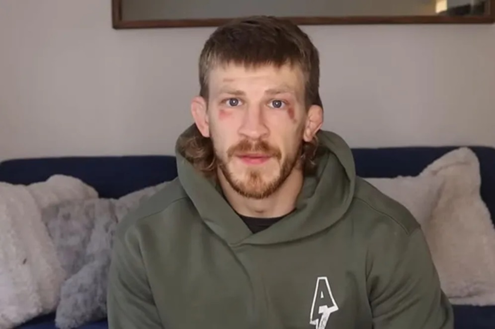 MMA borac i kandidat za UFC prebijen na ulici, a razlog je bizaran: Sav u modricama objavio snimak